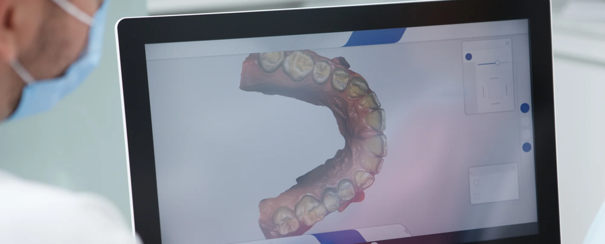 Pantalla mostrando radiografía 3D Bonachera y Romero